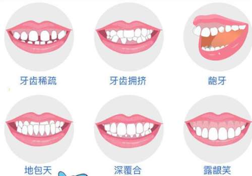 河北省优抚医院潘兴旺怎么样？牙齿矫正技术解析！含2026价格表插图3