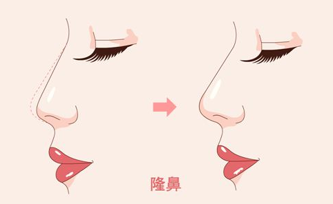 无锡丽都整形医院整形医生有哪些？推荐3位专业靠谱的医生插图2
