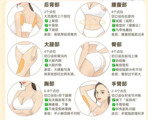 上海九院钱云良怎么样？技术、擅长项目盘点！隆鼻/隆胸口碑盘点！插图3