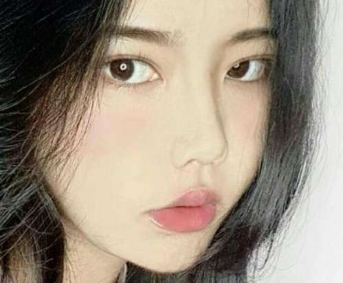 苏北医院陈啸双眼皮案例，让心灵的窗户更美插图2