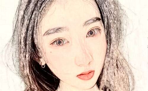 烟台玻尿酸去抬头纹医生有哪些插图1 烟台玻尿酸去抬头纹医生有哪些插图1