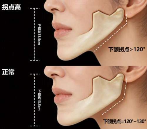 李逸松医生怎么预约？附真实术后口碑供您参考！速速收藏插图4