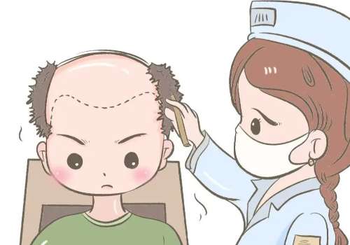 遂宁中心医院植发价格需要多少?低至9k起!科室介绍及真实案例分析!插图 遂宁中心医院植发价格需要多少?低至9k起!科室介绍及真实案例分析!插图