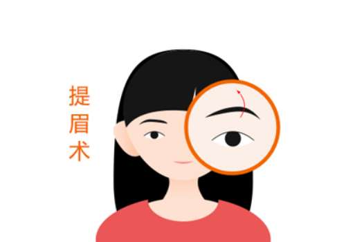 上海十院整形科提眉手术费用多少?3000元起!专家_案例分享都有插图1 上海十院整形科提眉手术费用多少?3000元起!专家_案例分享都有插图1