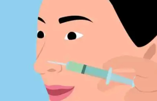 合肥注射隆鼻一针多少钱?不同产品价格对比+常见问答,一文搞懂注射隆鼻价格和避坑要点插图 合肥注射隆鼻一针多少钱?不同产品价格对比+常见问答,一文搞懂注射隆鼻价格和避坑要点插图