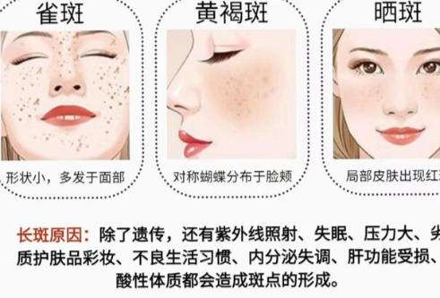 姚春丽挂号怎么约？附预约面诊流程及案例效果讲解！插图4