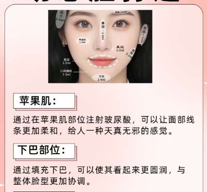 成都少女针多少钱一针?价格贵不贵?看完再决定做不做,附口碑医院插图1 成都少女针多少钱一针?价格贵不贵?看完再决定做不做,附口碑医院插图1