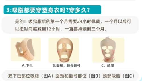 浙一医院抽脂怎么收费2026价格表单来袭!医生技术优势及网友点评!插图4 浙一医院抽脂怎么收费2026价格表单来袭!医生技术优势及网友点评!插图4