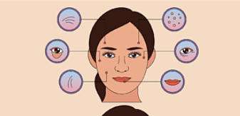 北京301医院玻尿酸多少钱?薛紫涵、郭伶俐谁做的更好?插图2 北京301医院玻尿酸多少钱?薛紫涵、郭伶俐谁做的更好?插图2