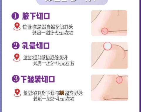 王晋煌医生口碑怎样？附人气项目推荐及案例反馈插图3