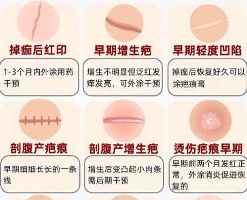 王连召出诊时间挂号流程详细介绍！含术后注意事项速速来看插图1