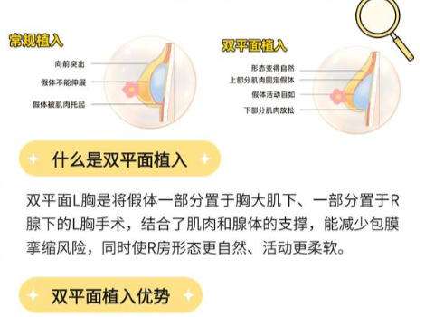 郑州脂肪隆胸手术价格怎么样?含人气医院详细介绍及项目价格表更新插图3 郑州脂肪隆胸手术价格怎么样?含人气医院详细介绍及项目价格表更新插图3