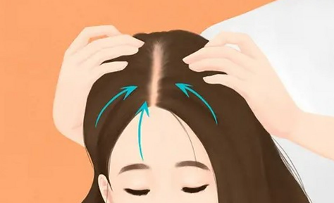 上海植发多少钱一个毛囊：毛囊单价、打包价格、优惠政策解析插图2