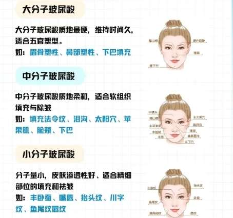 嘉兴打少女针多少钱?全新价格表公布!点击收藏插图 嘉兴打少女针多少钱?全新价格表公布!点击收藏插图