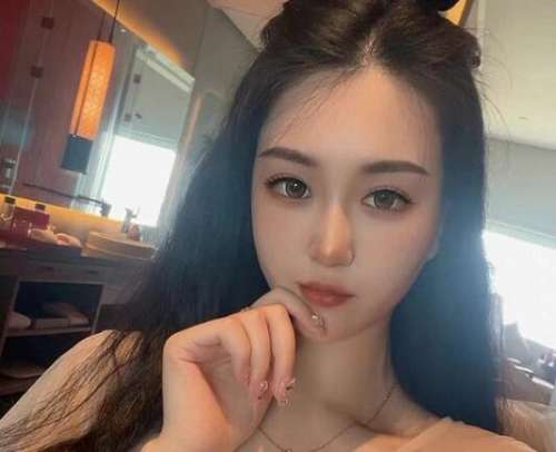 白明医生双眼皮手术案例，术后效果让我重拾自信插图1