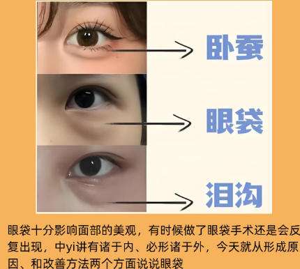 冷向锋医生擅长什么手术？双眼皮、祛眼袋项目介绍！插图2
