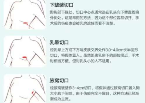 安徽省立医院脂肪填充价格表单新鲜出炉!医院信息相关简介!插图3 安徽省立医院脂肪填充价格表单新鲜出炉!医院信息相关简介!插图3