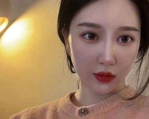 白明医生双眼皮手术案例，术后效果让我重拾自信插图3
