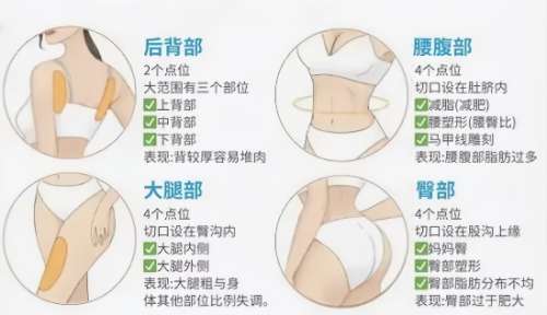 安徽省立医院磨骨手术价格公布一览！专业医生团队及服务态度分析！插图3