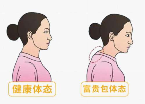 王皓宇医生富贵包手术评价咋样？蚌埠中心医院“关节镜微创第一人”，网友反馈：两个小孔解决问题！插图2