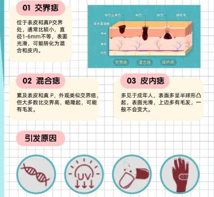 上海九院李东切痣怎么样？切痣技术剖析！费用低至7k左右插图3