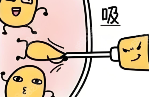北京协和吸脂手术多少钱啊?手术费、住院费一文拆给你看插图 北京协和吸脂手术多少钱啊?手术费、住院费一文拆给你看插图
