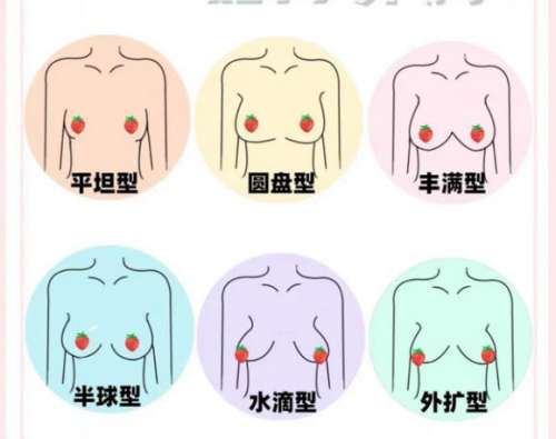 重庆脂肪隆胸多少钱？2026全新价格点评！收藏再看插图