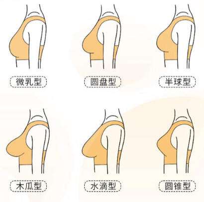 重庆假体隆胸医生排名榜单更新！薛斌、陈亮实力在线！插图4