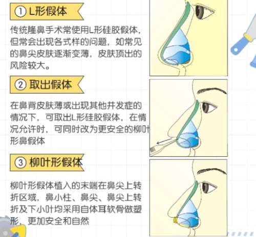 华西医院美容科收费标准!医生擅长项目案例鉴赏!插图4 华西医院美容科收费标准!医生擅长项目案例鉴赏!插图4