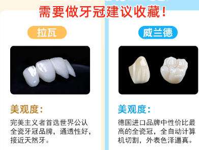 沈阳美容冠修复哪里好?多少钱?价格表更新!插图1 沈阳美容冠修复哪里好?多少钱?价格表更新!插图1
