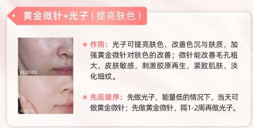 西南医院黄金微针价格表参考！院内皮肤技术优势分析！插图5