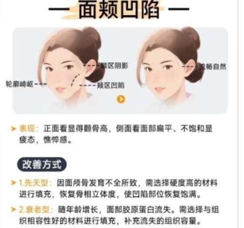北京301医院祛眼袋需要多少钱?戳进来看具体相关介绍!插图1 北京301医院祛眼袋需要多少钱?戳进来看具体相关介绍!插图1