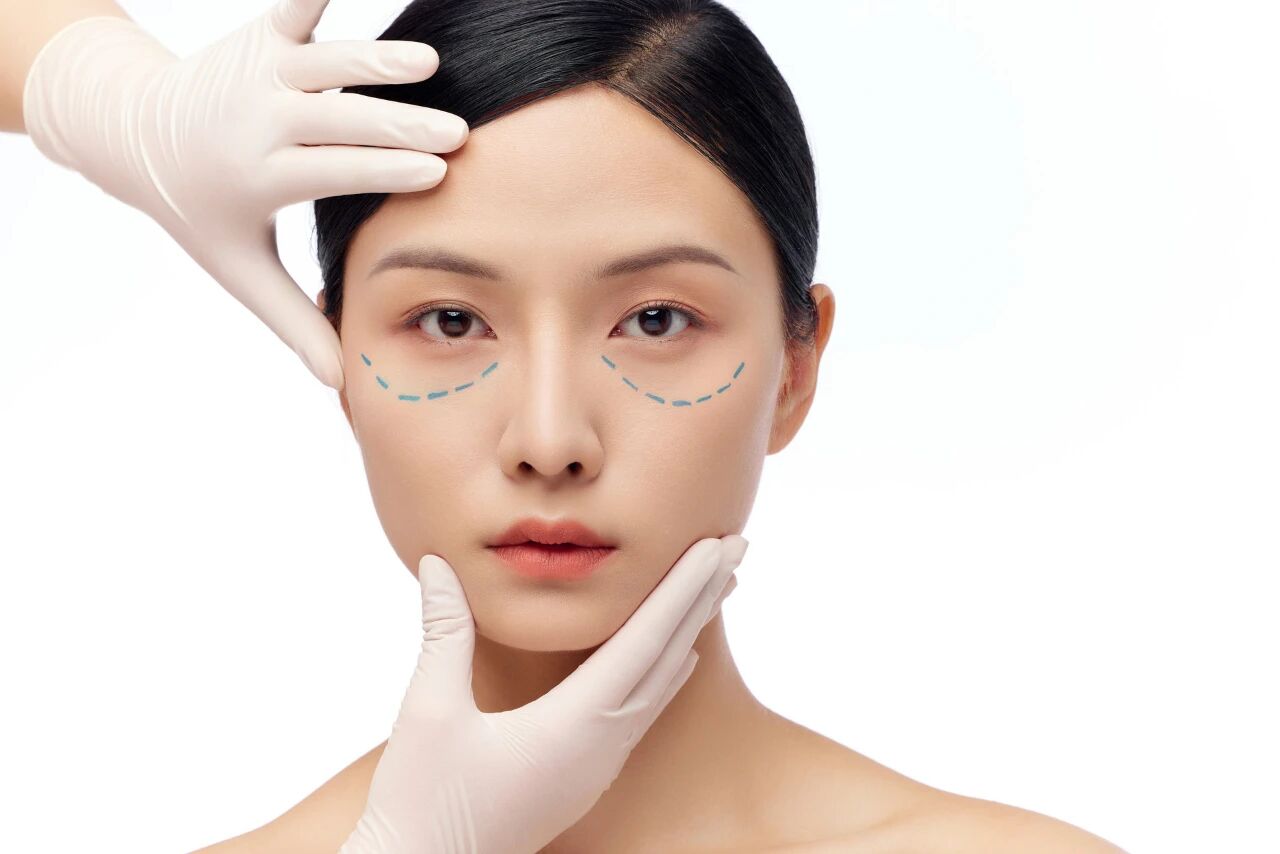 眼部吸脂手术会反弹么?眼袋美容手术方法插图 眼部吸脂手术会反弹么?眼袋美容手术方法插图