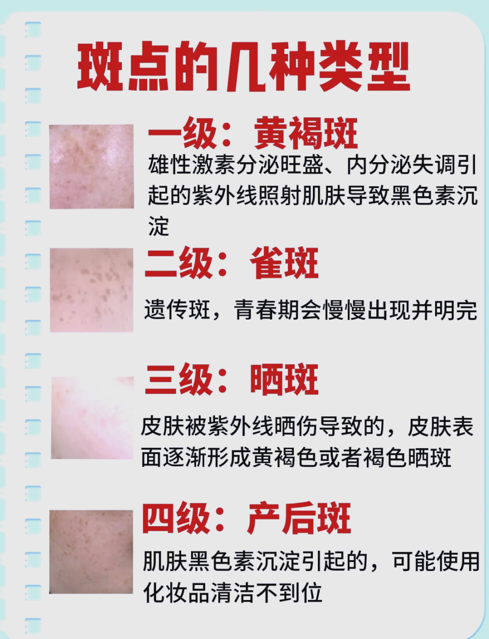 北京超皮秒祛斑价格多少钱?超皮秒祛斑多少钱一次效果如何插图1 北京超皮秒祛斑价格多少钱?超皮秒祛斑多少钱一次效果如何插图1