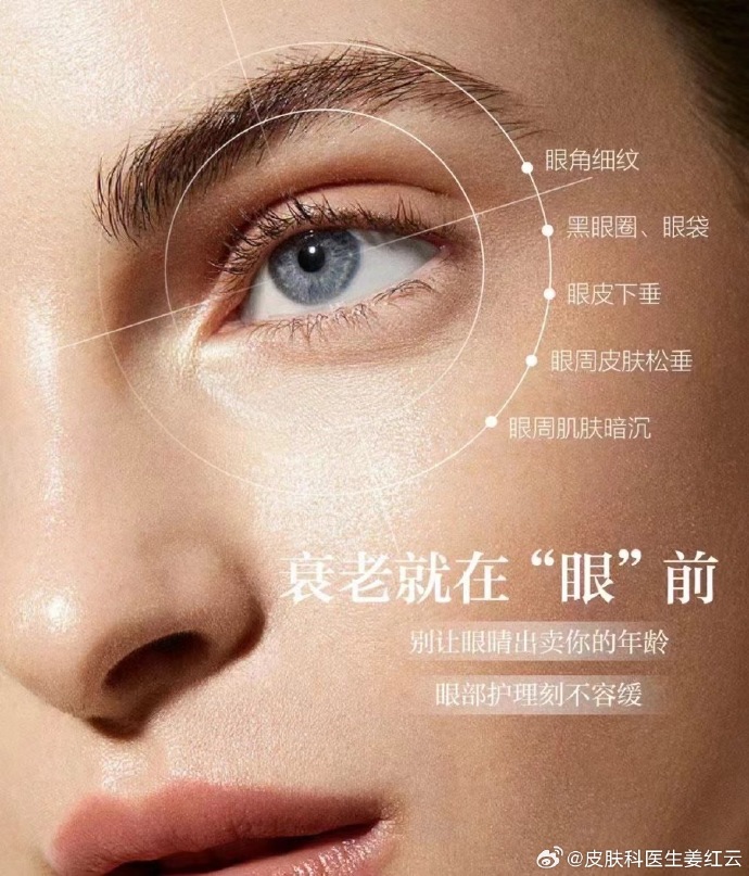 北京热玛吉眼周价格多少钱？热玛吉眼周治疗费用及效果插图