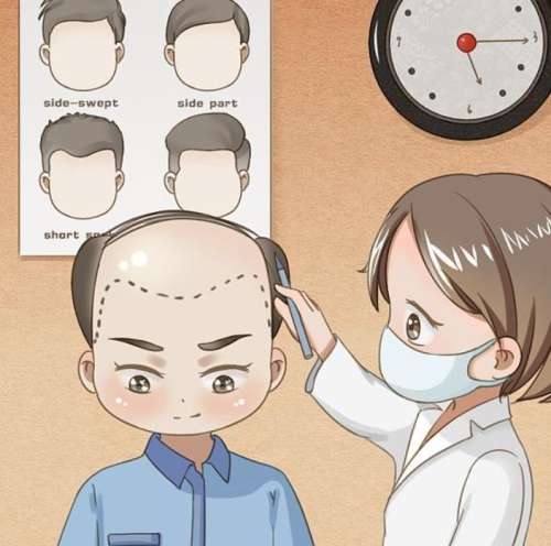 种植发际线一般多少钱啊?大约在10000元至48,000元插图 种植发际线一般多少钱啊?大约在10000元至48,000元插图