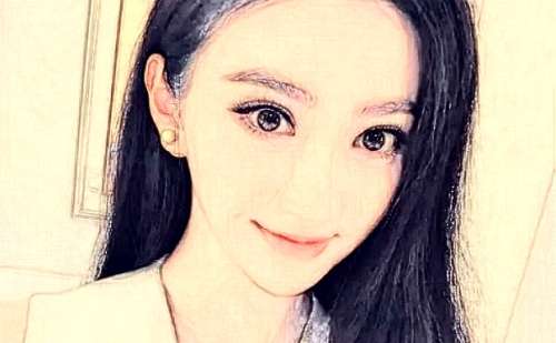 常州市第一人民医院玻尿酸填充价格一览表?术后120天案例,医院点评插图2 常州市第一人民医院玻尿酸填充价格一览表?术后120天案例,医院点评插图2