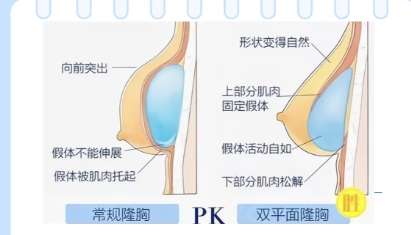 郭万厚医生口碑怎么样?胸部整形煤医尚美整形插图1 郭万厚医生口碑怎么样?胸部整形煤医尚美整形插图1