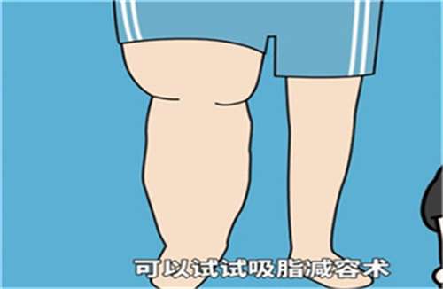大腿吸脂多少钱啊?价格解析来袭,看技术优势插图3 大腿吸脂多少钱啊?价格解析来袭,看技术优势插图3