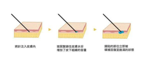 合肥医美抗衰靠谱排名整理!一键收藏宝藏医院医生干货插图1 合肥医美抗衰靠谱排名整理!一键收藏宝藏医院医生干货插图1