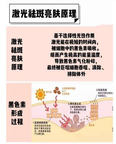 深圳阳光整形医院激光祛斑价格多少插图1