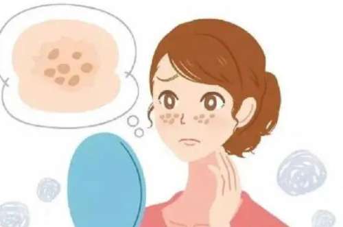 上海九院皮秒祛斑价格表介绍！项目知识科普！术前必看！插图4