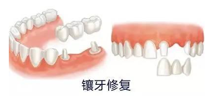 宝鸡市口腔医院怎么挂号?预约流程+避坑经验直接抄插图2 宝鸡市口腔医院怎么挂号?预约流程+避坑经验直接抄插图2