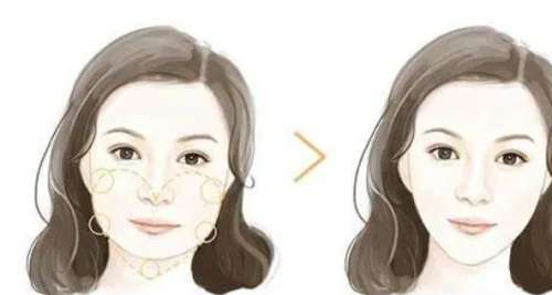 激光溶脂瘦脸多少钱?价格大概在3千到6千元插图 激光溶脂瘦脸多少钱?价格大概在3千到6千元插图