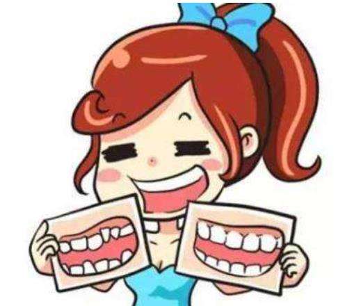 地包天矫正需要多少钱插图1 地包天矫正需要多少钱插图1