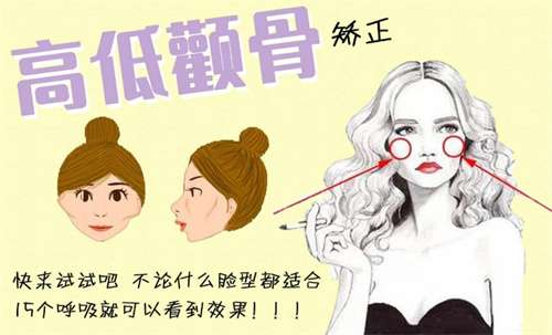 颧骨整形多少钱?价格明细公布,2026年新公布插图2 颧骨整形多少钱?价格明细公布,2026年新公布插图2