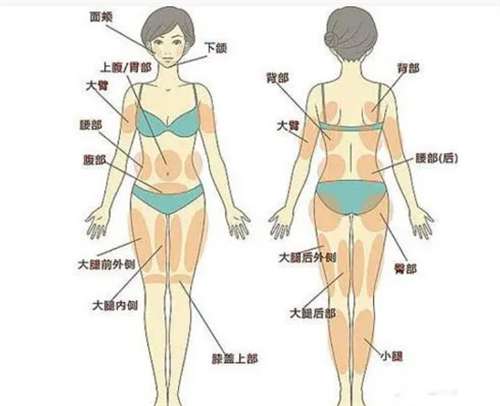 长沙吸脂多少钱?价格一览及手术风险与疗程解读插图 长沙吸脂多少钱?价格一览及手术风险与疗程解读插图