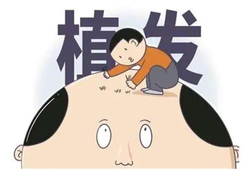 石家庄植发手术的收费标准是什么?透视头顶之美投入成本分析插图3 石家庄植发手术的收费标准是什么?透视头顶之美投入成本分析插图3