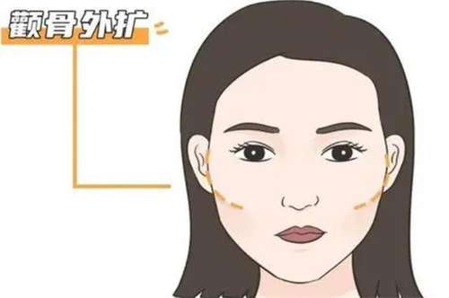 北京颧骨整形多少钱?2026年价格一览及不同整形方案解析插图1 北京颧骨整形多少钱?2026年价格一览及不同整形方案解析插图1
