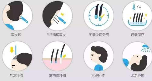 植发三千个单位多少钱插图2 植发三千个单位多少钱插图2